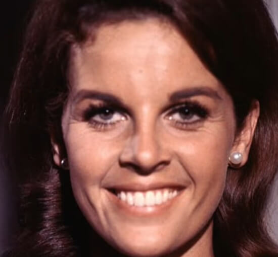 Claudine Longet Cause Of Death