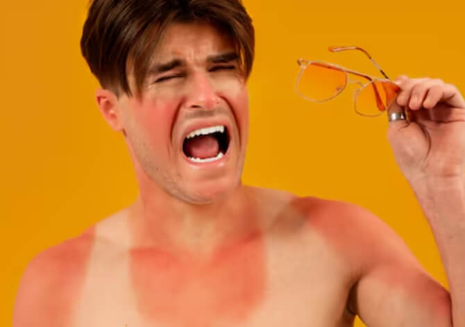 Chlorine Rash Why Your Skin Burns After Every Pool Day