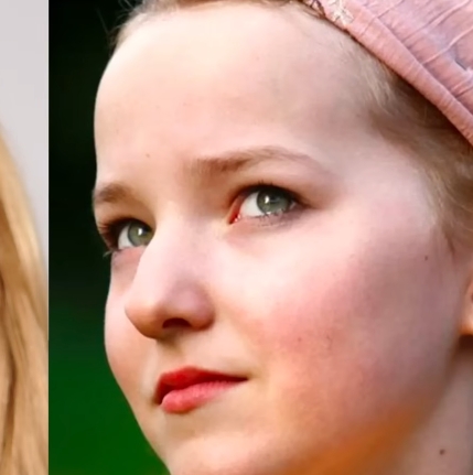 Dove Cameron Before Plastic Surgery